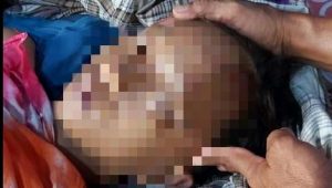 Jatuh dari Pohon, Pelajar di Luwu Timur Meregang Nyawa