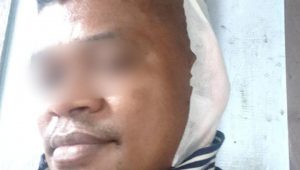 SADIS!!! Tagih Utang, Telinga Perantau Asal NTT di Palopo Digigit Hingga Putus
