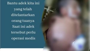 Bayi Laki-laki di Luwu Ditelantarkan Orang Tua Kandungnya, Kini Harus Menjalani Operasi di Rumah Sakit