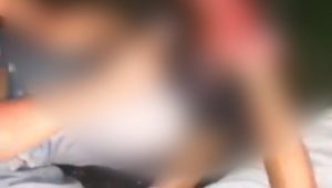 Rayakan Malam Pergantian Tahun Baru, Tangan Kiri Warga Lamasi Hancur Karena Ledakan Petasan