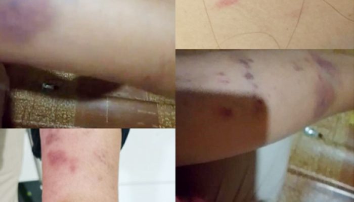 Misnawati Warga Luwu, Lapor ke Polsek Ponrang sebagai Korban Penganiayaan Malah jadi Pelaku Berujung Vonis Penjara